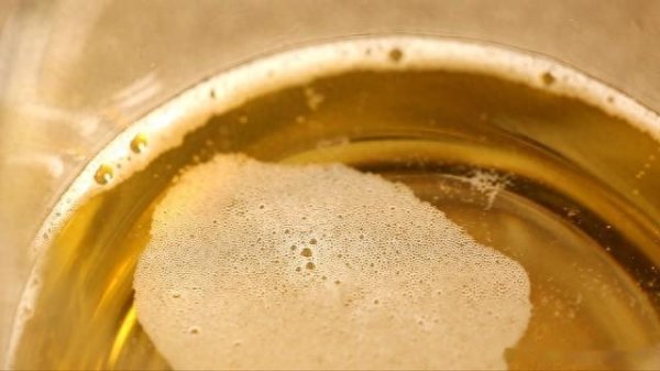 慢性肾病别乱用药! 6种护肾中成药, 降低尿蛋白、延缓肾衰